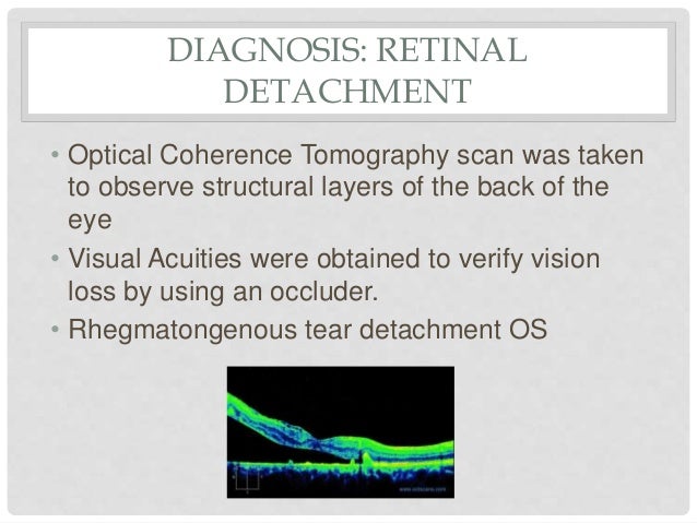 Ophthalmology clinical case studies pdf image