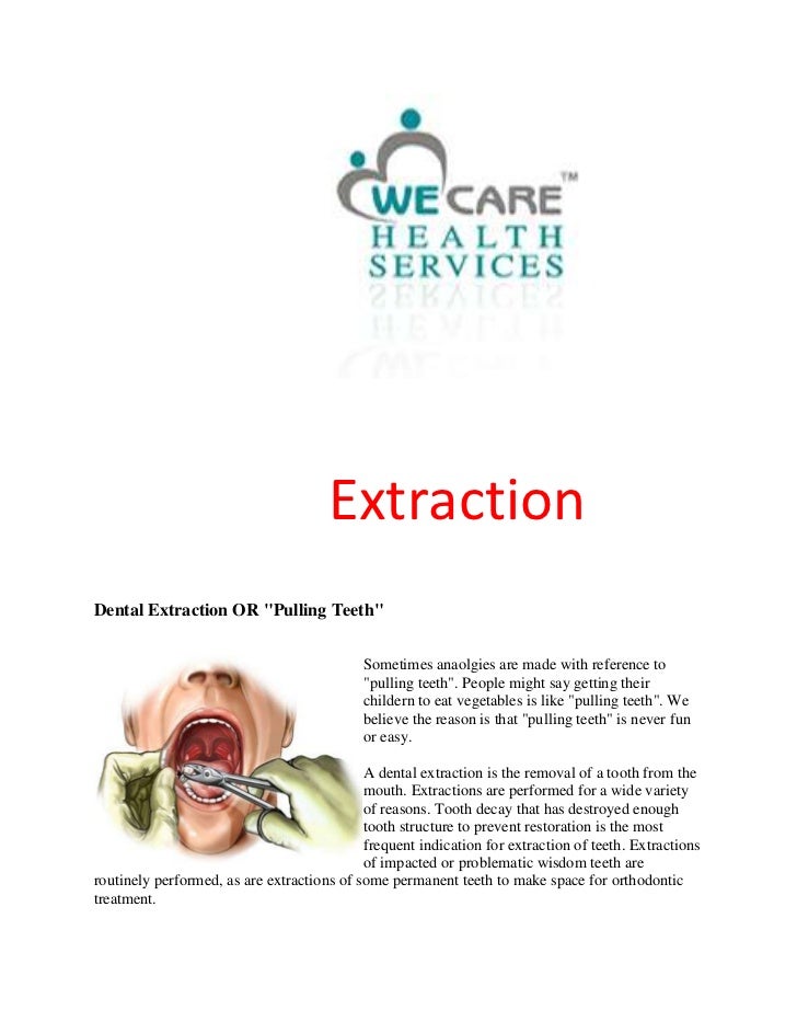 Dental Extraction Treatment in India at Mumbai and Delhi at LOwest Cost