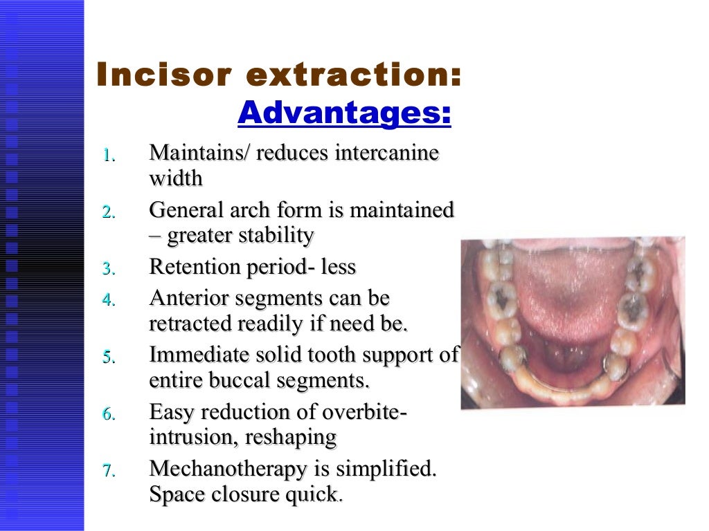 methods of gaining space in orthodontics Extraction