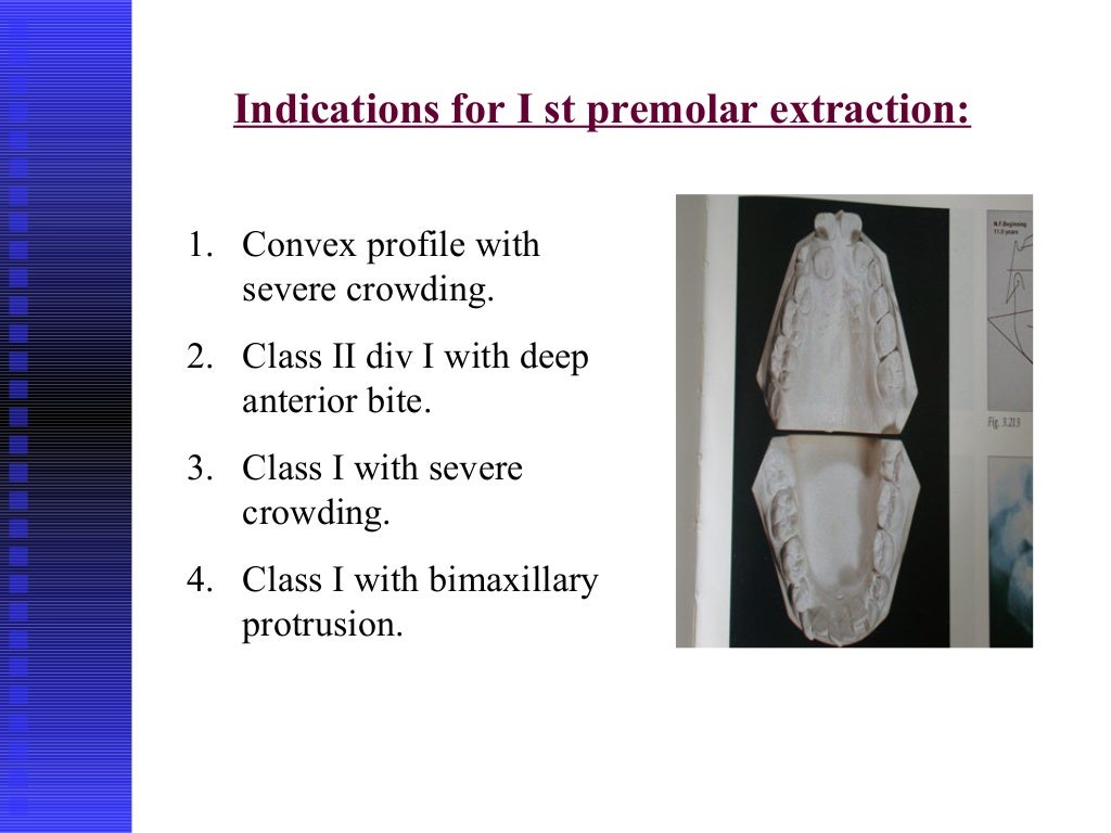 methods of gaining space in orthodontics Extraction