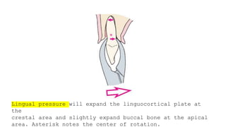 Simple Routine Extraction Routine Exodontia - simple extraction | PPTX