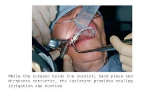 Simple Routine Extraction Routine Exodontia - simple extraction | PPTX