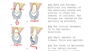 Simple Routine Extraction Routine Exodontia - simple extraction | PPTX