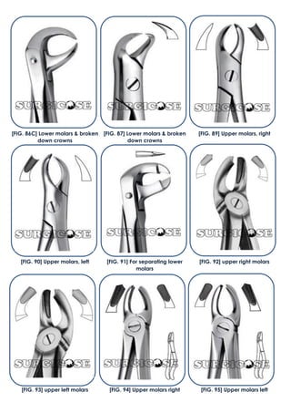 [FIG. 90] Upper molars, left [FIG. 91] For separating lower
molars
[FIG. 92] upper right molars
[FIG. 93] upper left molars [FIG. 94] Upper molars right [FIG. 95] Upper molars left
[FIG. 86C] Lower molars & broken
down crowns
[FIG. 87] Lower molars & broken
down crowns
[FIG. 89] Upper molars, right
 