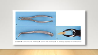 Cold Foreceps Extraction foreceps | PPTX