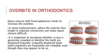 OVERBITE IN ORTHODONTICS
•Space closure with fixed appliances tends to
increase the overbite.
• In some malocclusions, where the anterior face
height is reduced, extractions can make space
closure difficult.
• It is important to recognize whether a case is
genuinely crowded or whether the teeth are
displaced lingually. Lingually displaced lower
labial segments are frequently not crowded, even
though they may appear to be so.
13
 