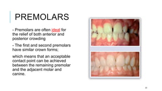 PREMOLARS
- Premolars are often ideal for
the relief of both anterior and
posterior crowding
- The first and second premolars
have similar crown forms;
which means that an acceptable
contact point can be achieved
between the remaining premolar
and the adjacent molar and
canine.
22
 