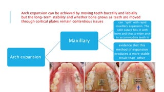 Arch expansion
Maxillary
The suture in the maxilla
can ‘split’ with rapid
maxillary expansion. The
split suture fills in with
bone and thus a wider arch
to accommodate teeth is
created..There is no good
evidence that this
method of expansion
produces a more stable
result than other
methods
Mandibular
Increasing mandibular
length to accommodate
teeth relapses in nearly
90% of cases
Arch expansion can be achieved by moving teeth buccally and labially
but the long-term stability and whether bone grows as teeth are moved
through cortical plates remain contentious issues
5
 