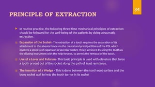 Simple Routine Extraction Extraction in pediatric dentistry........ | PPTX