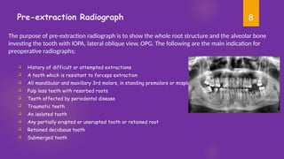 Pre Extraction Radiograph Extraction in pediatric dentistry........ | PPTX