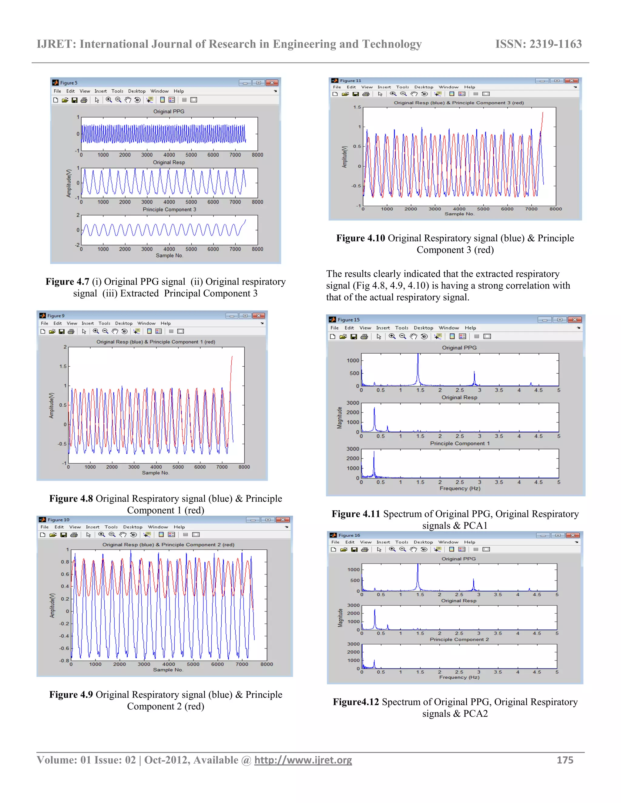 IJRET: International Journal of Research in Engineering and Technology ISSN: 2319-1163
__________________________________________________________________________________________
Volume: 01 Issue: 02 | Oct-2012, Available @ http://www.ijret.org 175
Figure 4.7 (i) Original PPG signal (ii) Original respiratory
signal (iii) Extracted Principal Component 3
Figure 4.8 Original Respiratory signal (blue) & Principle
Component 1 (red)
Figure 4.9 Original Respiratory signal (blue) & Principle
Component 2 (red)
Figure 4.10 Original Respiratory signal (blue) & Principle
Component 3 (red)
The results clearly indicated that the extracted respiratory
signal (Fig 4.8, 4.9, 4.10) is having a strong correlation with
that of the actual respiratory signal.
Figure 4.11 Spectrum of Original PPG, Original Respiratory
signals & PCA1
Figure4.12 Spectrum of Original PPG, Original Respiratory
signals & PCA2
 