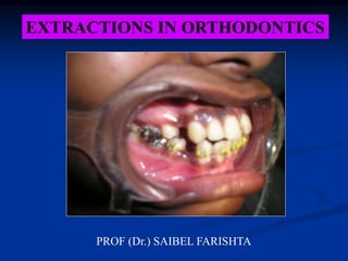 EXTRACTIONS IN ORTHODONTICS
PROF (Dr.) SAIBEL FARISHTA
 