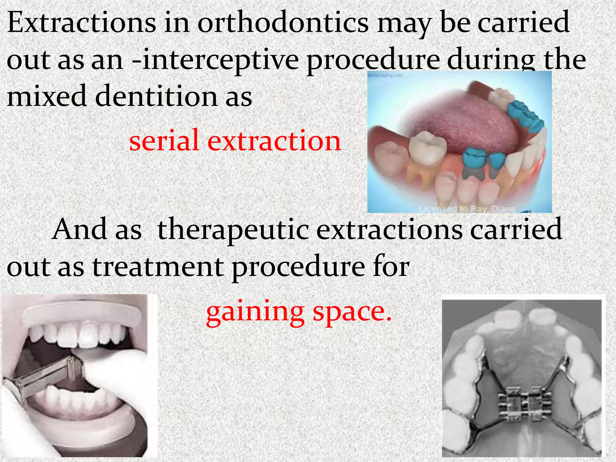 Extraction teeth for gaining space in orthodontics | PPTX