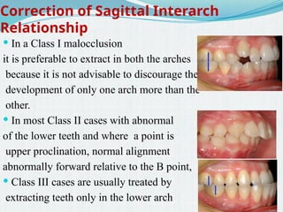 Tooth Case Classification extractionteethforgainingspaceinorthodontics.pptx