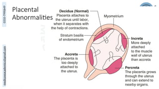 medicoseacademics@gmail.com
0310-7990649
Placental
Abnormalities
33
 