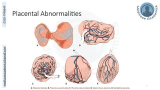 medicoseacademics@gmail.com
0310-7990649
Placental Abnormalities
34
 
