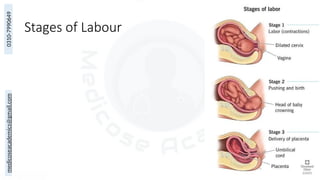 medicoseacademics@gmail.com
0310-7990649
Stages of Labour
76
 