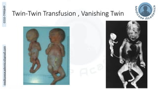 medicoseacademics@gmail.com
0310-7990649
Twin-Twin Transfusion , Vanishing Twin
96
 
