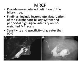 MRCP
• Provide more detailed definition of the
biliary tree.
• Findings- include incomplete visualization
of the extrahepatic biliary system and
periportal high-signal intensity on T2-
weighted MRI scans
• Sensitivity and specificity of greater than
90%
 