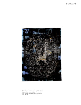 Ernest Breleur 13




Chirurgie sur une jeune femme qui rêve d’avoir
un petit chien à tête de lune
1997, Collages radiographiques, gommettes
235 x 165 cm
 