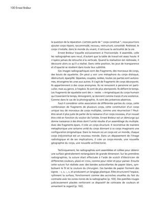 100 Ernest Breleur




                     la question de la réparation. L’artiste parle de “ corps constitué ”, nous pourrions
                     ajouter corps réparé, raccommodé, recousu, restructuré, consolidé. Redressé, le
                     corps s’installe, dans le monde du vivant, il retrouve la verticalité de la vie.
                            Ernest Breleur travaille exclusivement à l’horizontale. Il assemble, colle
                     les radiographies sans recul, d’autant que la table de travail est assez haute. Il
                     n’opère jamais de retouche à la verticale. Quand la réalisation est redressée, il
                     découvre alors ce qu’il a réalisé. Dans cette position, les jeux de transparence
                     et d’opacité se révèlent dans toute leur subtilité.
                           Ces images radiographiques sont des fragments, des morceaux de corps,
                     des bouts de squelette. On peut y voir une métaphore du corps disloqué,
                     déstructuré, éparpillé. Séparées, coupées, isolées, toutes ces parties sont autono-
                     mes, étrangères les unes aux autres. Il s’agit de fragments de corps décorporés.
                     Ils appartiennent à des corps anonymes. Ils ne renvoient à personne en parti-
                     culier, mais au genre, à l’espèce. Ils sont de plus atemporels. Ils défient le temps.
                     Les fragments de squelette sont des « restes » énigmatiques du corps humain
                     qui traversent le temps, témoignent, se donnent comme traces d’une existence.
                     Comme dans le cas de la photographie, ils sont des présences-absences.
                            Faut-il considérer cette association de différentes parties du corps, cette
                     combinaison de fragments de plusieurs corps, cette constitution d’un corps
                     unique issu de morceaux de corps multiples, comme une résurrection ? Peut-
                     être serait-il plus juste de parler de la naissance d’un corps nouveau, d’un nouvel
                     être créé en fonction du vouloir de l’artiste. Ernest Breleur est un démiurge qui
                     donne naissance à des êtres dont l’unité résulte d’un assemblage du multiple.
                     Avec des fragments épars, il crée un corps structuré. Il reconstitue de manière
                     métaphorique une certaine unité du corps donnant à ce corps imaginaire une
                     configuration énigmatique. Dans la mesure où un corps est un monde, chaque
                     corps (re)constitué est un nouveau monde. Dans un dépassement de l’image
                     radiologique et de ses implications, il crée un corps-monde, une nouvelle
                     géographie du corps, une nouvelle architectonie.


                           Techniquement, les radiographies sont assemblées et collées pour obtenir
                     une surface généralement rectangulaire de grande dimension. Sur les premières
                     radiographies, la suture était effectuée à l’aide de scotch d’électricien de
                     différentes couleurs, placé en croix, comme pour relier et pour panser. Ensuite
                     cette suture fut réalisée avec des bandes autocollantes de papier blanc, sym-
                     bolisant le fil et la couture du chirurgien. Ces bandes de papier forment des
                     signes : +, x, –, =, et produisent un langage plastique. Elles structurent l’espace,
                     rythment la surface, fonctionnent comme des accroches visuelles du fait du
                     contraste avec les zones noires de la radiographie [p. 103]. Des pastilles rouges
                     judicieusement placées renforcent ce dispositif de contraste de couleurs et
                     aimantent le regard [p. 102].
 