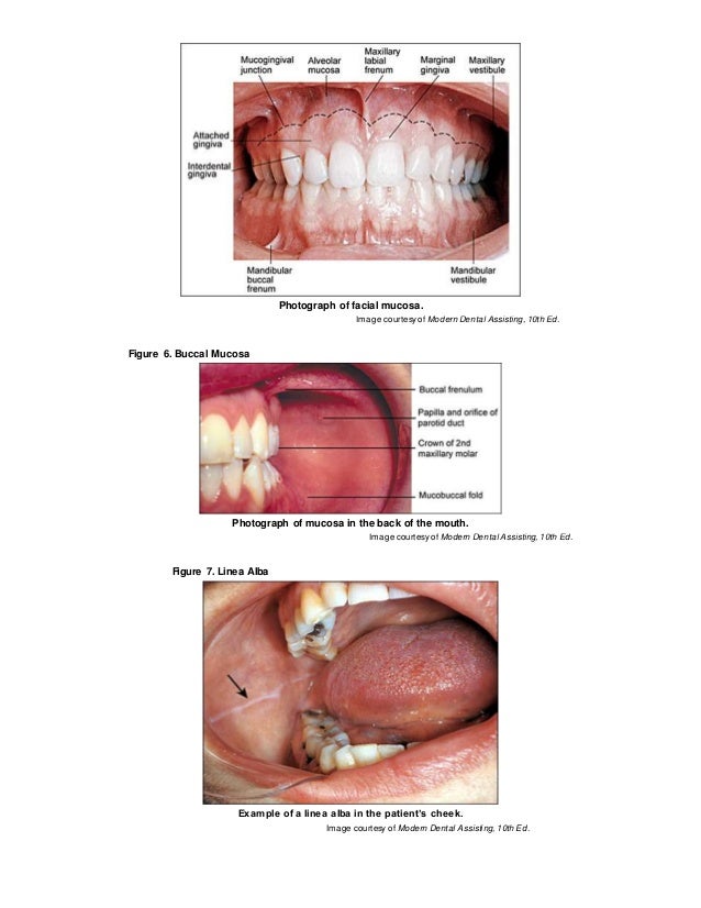 landmarks found in the oral cavity