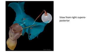 View from right supero-
posterior
12/25/2019 Ashim Chhusya
 