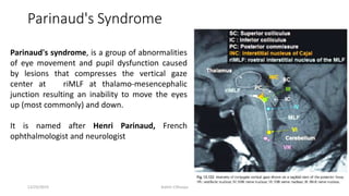 Parinaud's Syndrome
Parinaud's syndrome, is a group of abnormalities
of eye movement and pupil dysfunction caused
by lesions that compresses the vertical gaze
center at riMLF at thalamo-mesencephalic
junction resulting an inability to move the eyes
up (most commonly) and down.
It is named after Henri Parinaud, French
ophthalmologist and neurologist
12/25/2019 Ashim Chhusya
 