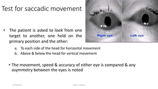 Test for saccadic movement
a. To each side of the head for horizontal movement
b. Above & below the head for vertical movement
• The movement, speed & accuracy of either eye is compared & any
asymmetry between the eyes is noted
• The patient is asked to look from one
target to another, one held on the
primary position and the other:
12/25/2019 Ashim Chhusya
 