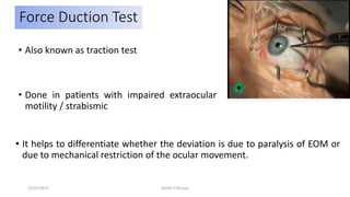 Force Duction Test
• Also known as traction test
• Done in patients with impaired extraocular
motility / strabismic
• It helps to differentiate whether the deviation is due to paralysis of EOM or
due to mechanical restriction of the ocular movement.
12/25/2019 Ashim Chhusya
 