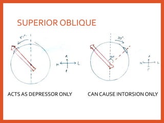 SUPERIOR OBLIQUE
ACTS AS DEPRESSOR ONLY CAN CAUSE INTORSION ONLY
 