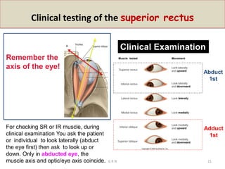 Clinical testing of the superior rectus
Clinical Examination
Adduct
1st
Abduct
1st
Remember the
axis of the eye!
For checking SR or IR muscle, during
clinical examination You ask the patient
or individual to look laterally (abduct
the eye first) then ask to look up or
down. Only in abducted eye, the
muscle axis and optic/eye axis coincide. G R N 21
 