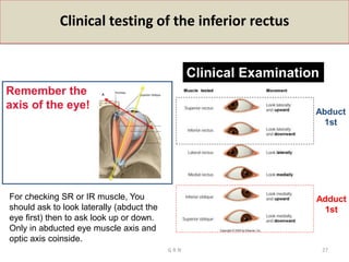 Clinical testing of the inferior rectus
Clinical Examination
Adduct
1st
Abduct
1st
Remember the
axis of the eye!
For checking SR or IR muscle, You
should ask to look laterally (abduct the
eye first) then to ask look up or down.
Only in abducted eye muscle axis and
optic axis coinside.
G R N 27
 