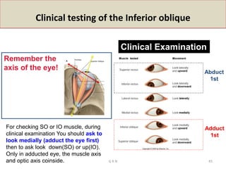 Clinical testing of the Inferior oblique
Clinical Examination
Adduct
1st
Abduct
1st
Remember the
axis of the eye!
For checking SO or IO muscle, during
clinical examination You should ask to
look medially (adduct the eye first)
then to ask look down(SO) or up(IO).
Only in adducted eye, the muscle axis
and optic axis coinside. G R N 45
 