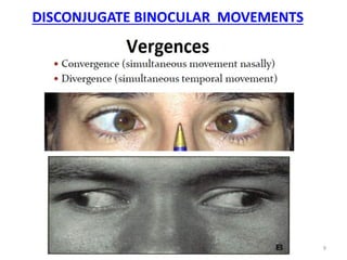 DISCONJUGATE BINOCULAR MOVEMENTS
G R N 9
 