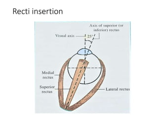 Recti insertion