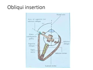 Obliqui insertion