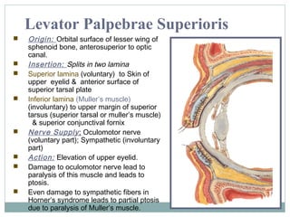 Levator Palpebrae Superioris














Origin: Orbital surface of lesser wing of
sphenoid bone, anterosuperior to optic
canal.
Insertion: Splits in two lamina
Superior lamina (voluntary) to Skin of
upper eyelid & anterior surface of
superior tarsal plate
Inferior lamina (Muller’s muscle)
(involuntary) to upper margin of superior
tarsus (superior tarsal or muller’s muscle)
& superior conjunctival fornix
Nerve Supply : Oculomotor nerve
(voluntary part); Sympathetic (involuntary
part)
Action: Elevation of upper eyelid.
Damage to oculomotor nerve lead to
paralysis of this muscle and leads to
ptosis.
Even damage to sympathetic fibers in
Horner’s syndrome leads to partial ptosis
due to paralysis of Muller’s muscle.

 
