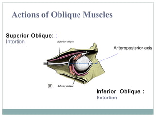 Actions of Oblique Muscles
Superior Oblique: :
Intortion

Anteroposterior axis

Inferior Oblique :
Extortion

 
