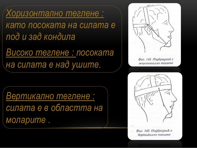 екстраорални апарати