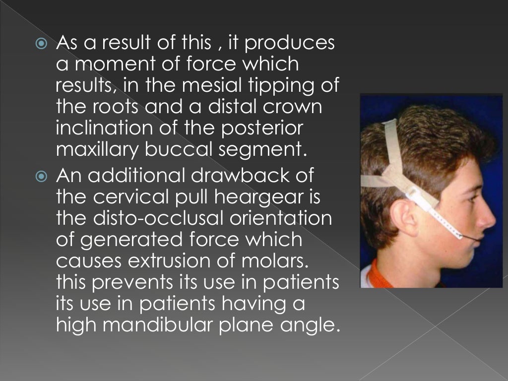 Extraoral appliances