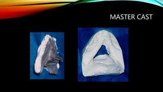 Master Cast Model Extra oral defects | PPTX