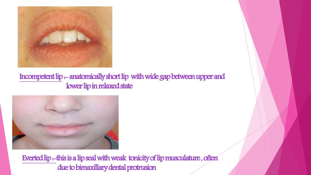 Extraoral examination