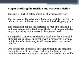 Step 2. Marking the Incision and Vasoconstriction

• The skin is marked before injection of a vasoconstrictor.

• The inci...