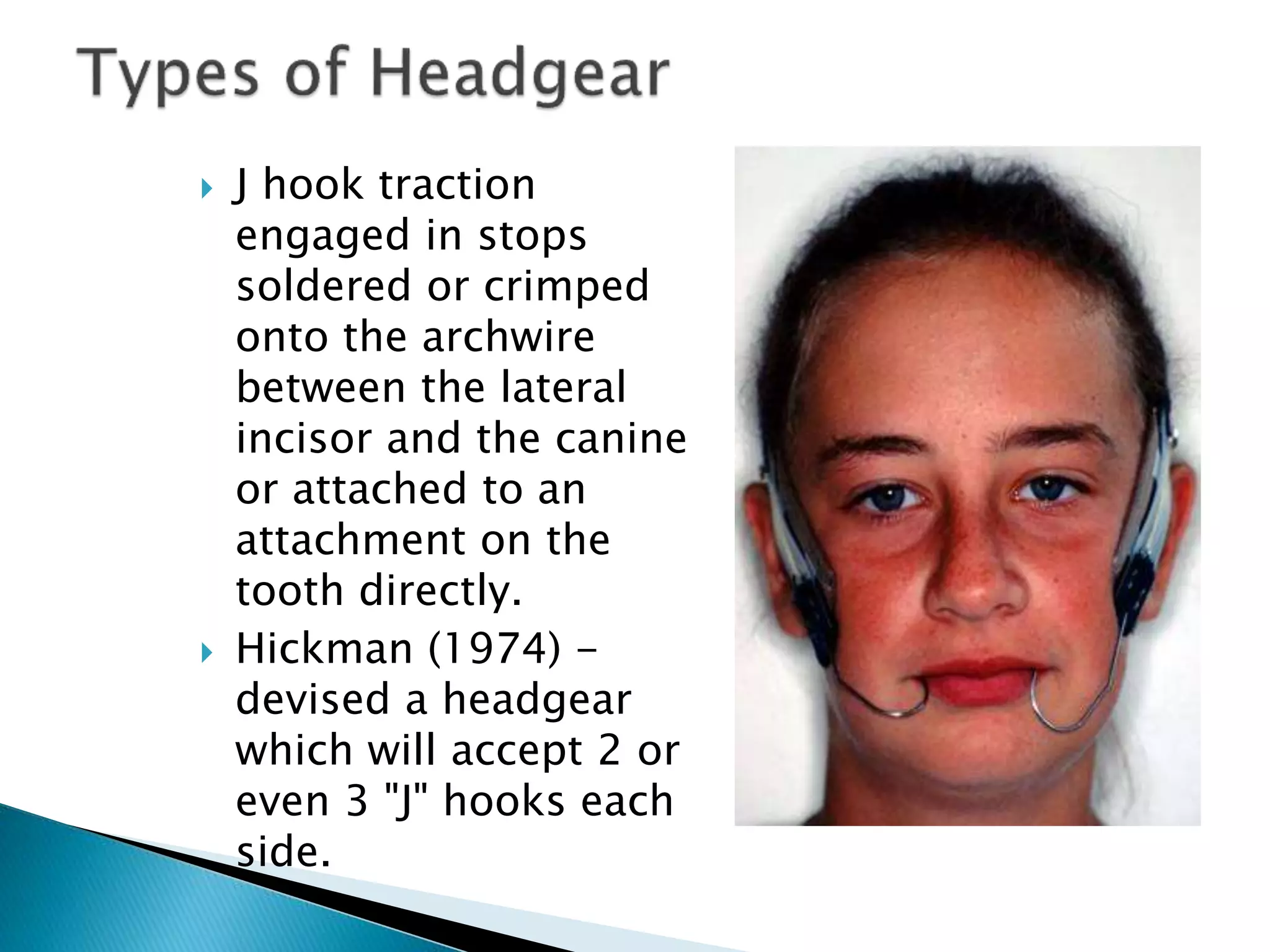 Extraoral orthodontic appliances / for orthodontists by Almuzian PPT