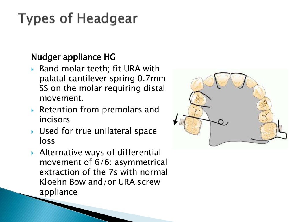 Extraoral orthodontic appliances / for orthodontists by Almuzian