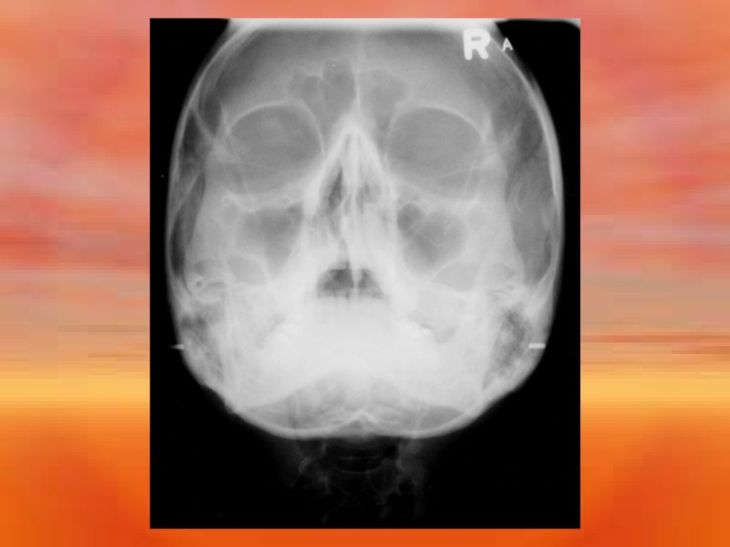 Extraoral Radiology Techniques II