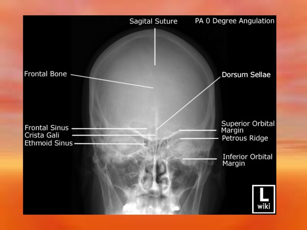 Extraoral Radiology Techniques II