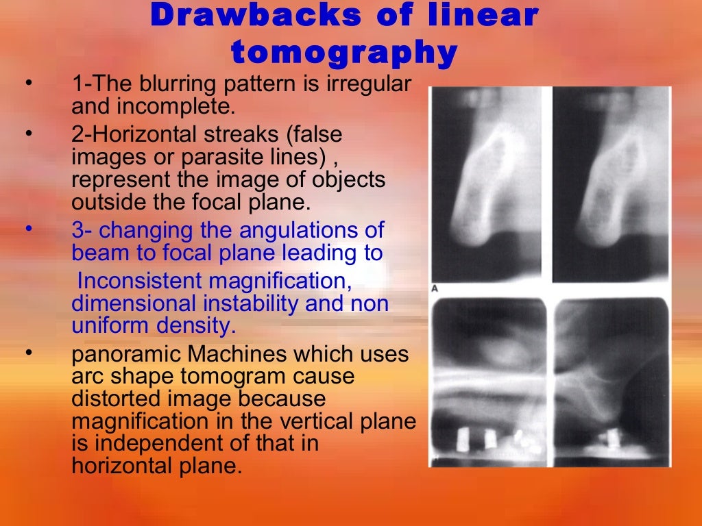 Extraoral Radiology Techniques II