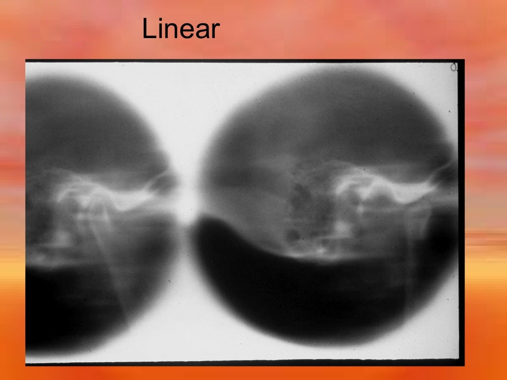 Extraoral Radiology Techniques II